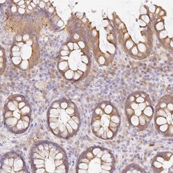 RAB6IP1 Antibody, Novus Biologicals 25 &mu;L, Unlabeled:Antibodies, Polyclonal